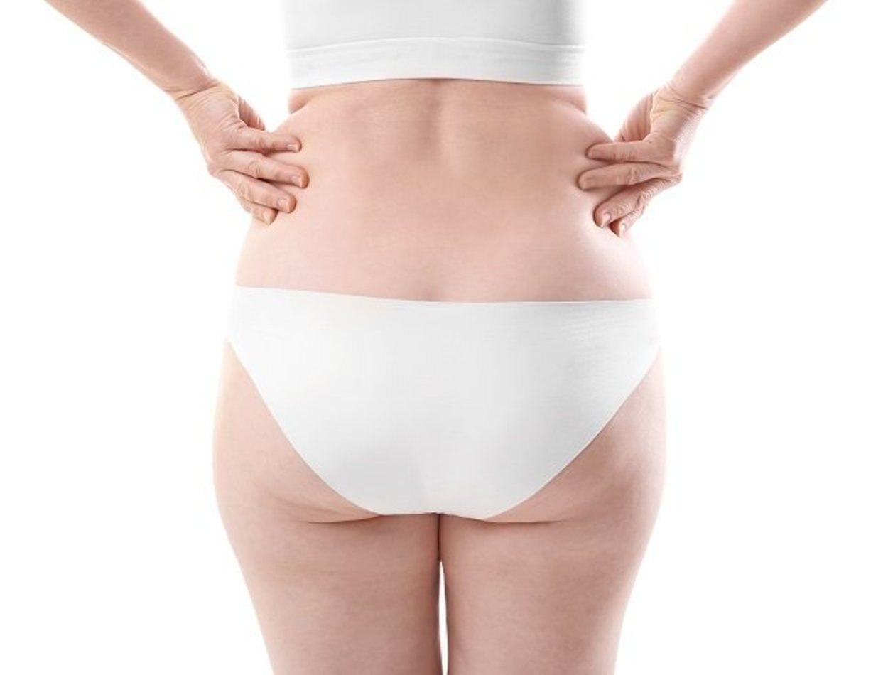 En Qué Consiste El Lipedema Bekia Salud 