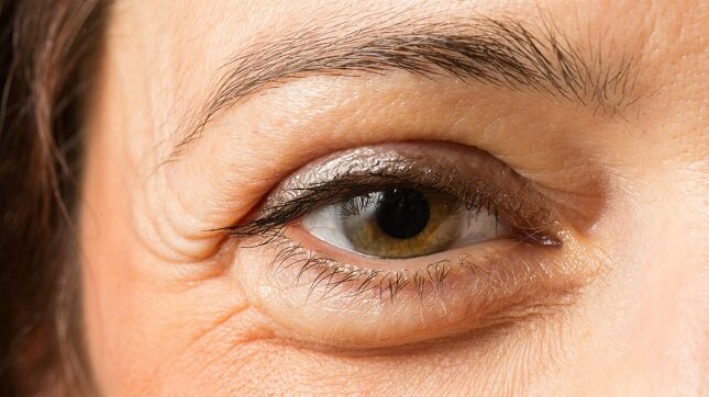  Las bolsas de los ojos no suelen provocar ningún tipo de problema de salud en las personas que las sufren