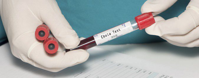Para determinar si una persona está infectada se realizan pruebas de laboratorio