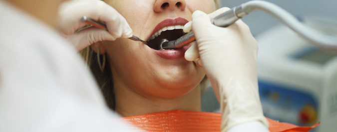 La periodontitis es una de las afecciones más graves que podemos tener tras la menopausia
