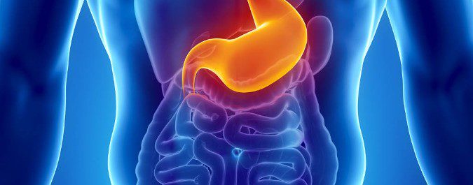 La enfermedad de Crohn consiste en la inflamación de distintas zonas del tracto intestinal