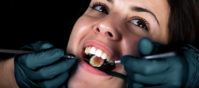  Es importante realizarse limpiezas dentales en el dentista para evitar la acumulación de sarro