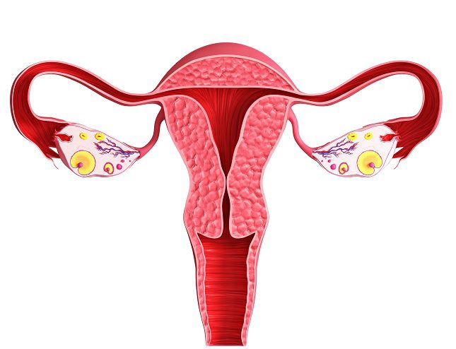 En el caso en que no sean cogidos a tiempo, los pólipos endometriales pueden llegar a convertirse en malignos 