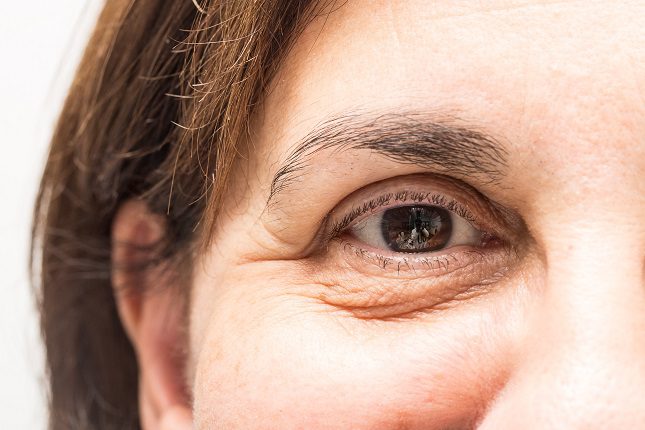 La piel alrededor de tus ojos es muy delgada y esto hace que sea extremadamente sensible