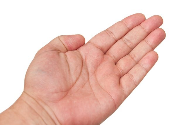 .El síndrome mano-pie, se produce como efecto secundario tras haber recibido un tratamiento