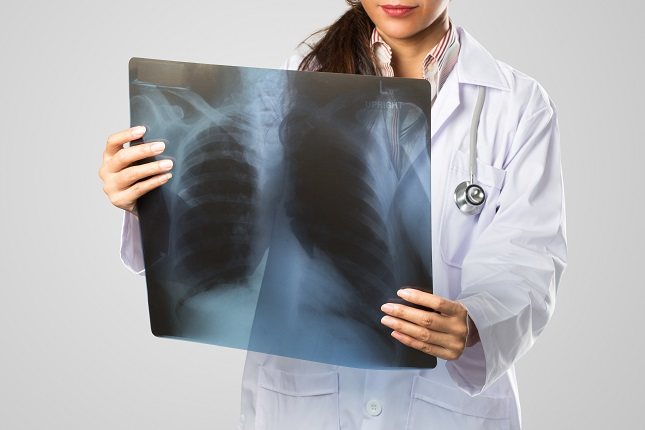 Realizar un diagnóstico certero de la hipertensión pulmonar no es nada fácil