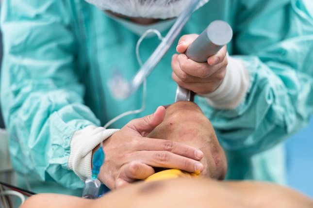 El procedimiento de la intubación orotraqueal puede tener diversas complicaciones