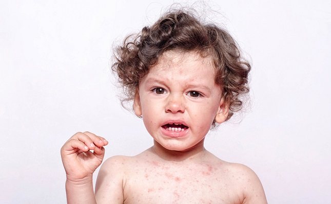 Los niños que no reciben vacunas se encuentran expuestos a todo tipo de enfermedades