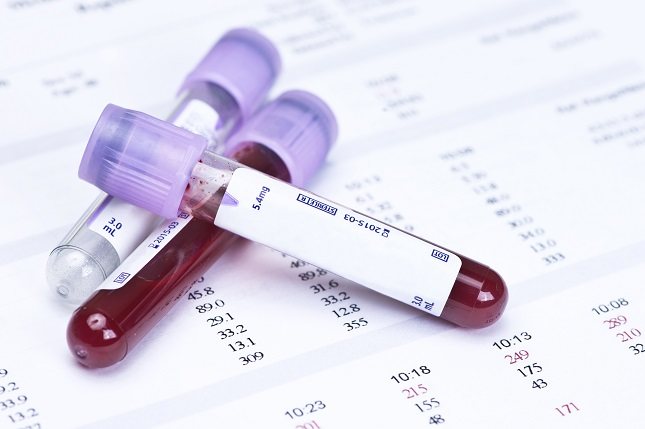 Los tipos de sangre están determinados por la presencia o ausencia de ciertas proteínas en los glóbulos rojos