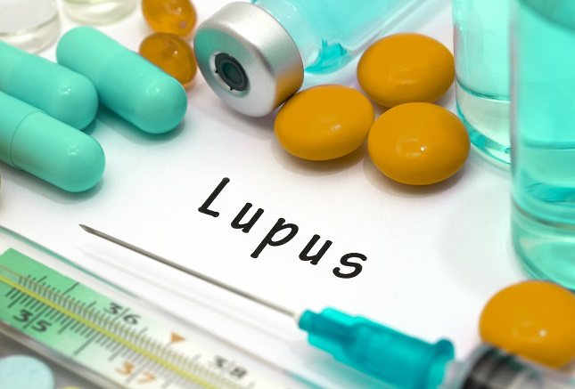 Si la mujer ha tenido familiares con dicha enfermedad es bastante probable que pueda llegar a padecer lupus