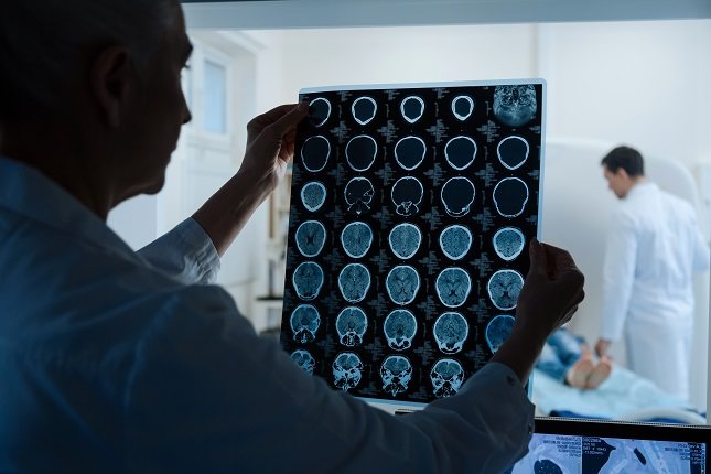 Los tumores cerebrales pueden aparecer en el cerebro mismo 