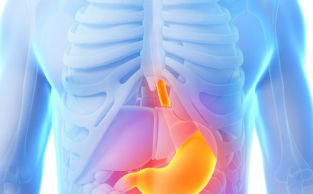 Una úlcera péptica también es capaz de perforar un órgano abdominal adyacente 