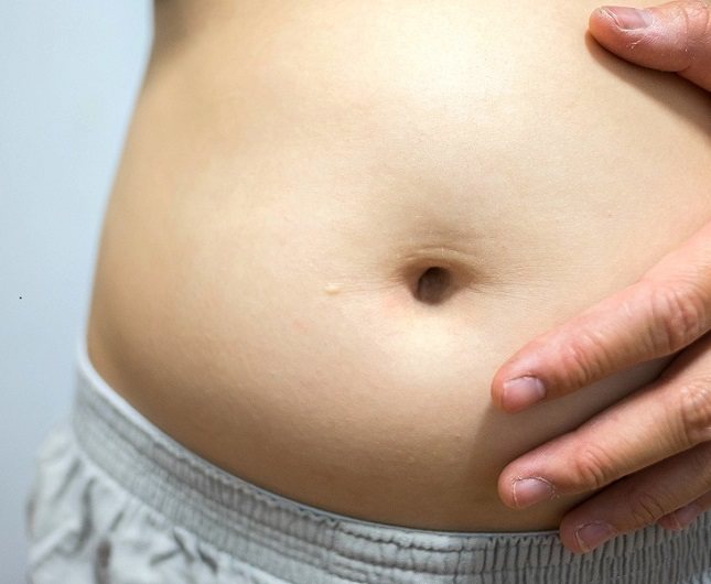 La obesidad tipo pera, a diferencia de la tipo manzana, acumula la grasa en la parte baja del abdomen