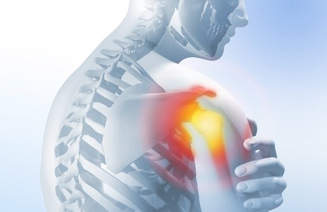 Es una de las lesiones más comunes del hombro