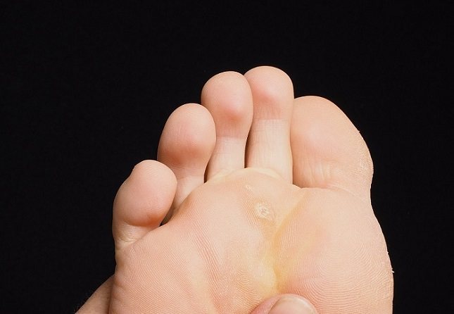 Si tienes las plantas de los pies amarillas, lo más probable es que se trate de un exceso de betacarotenos