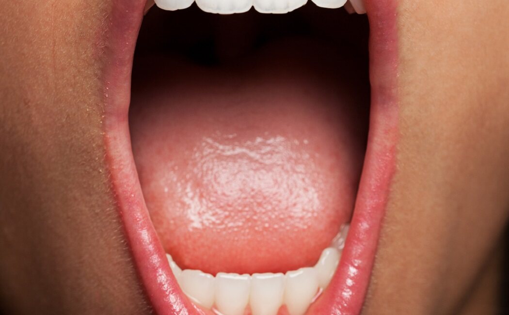 ¿Es normal que la boca se reseque?