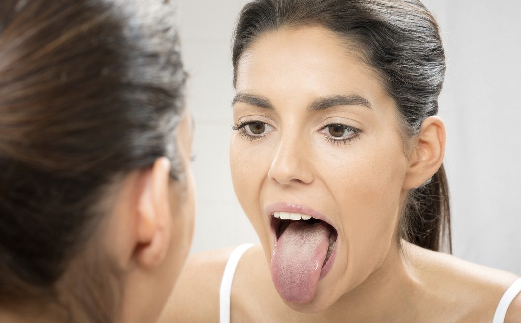 Remedios caseros para tratar la lengua blanca