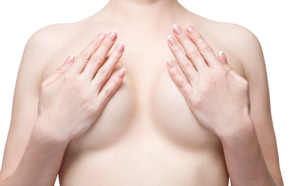 Diferencias entre mamoplastia y mastopexia