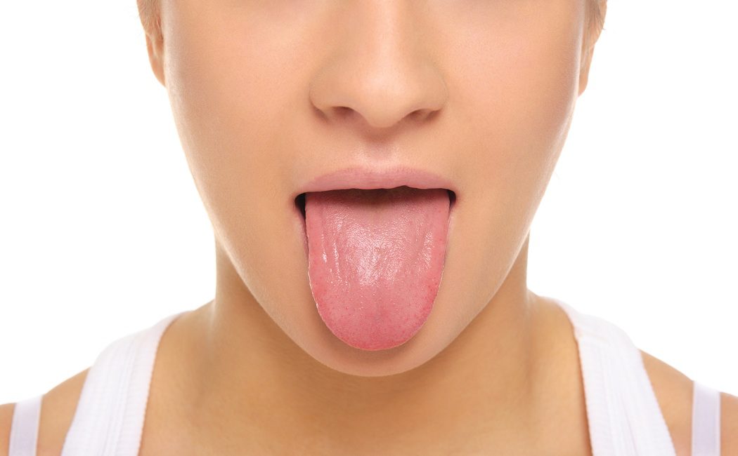 Qué es el cáncer de lengua