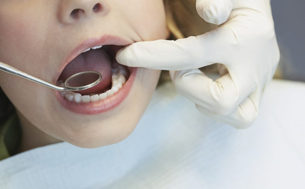 Por qué es tan importante acudir al dentista