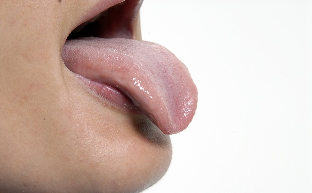 Por qué salen granos en la lengua