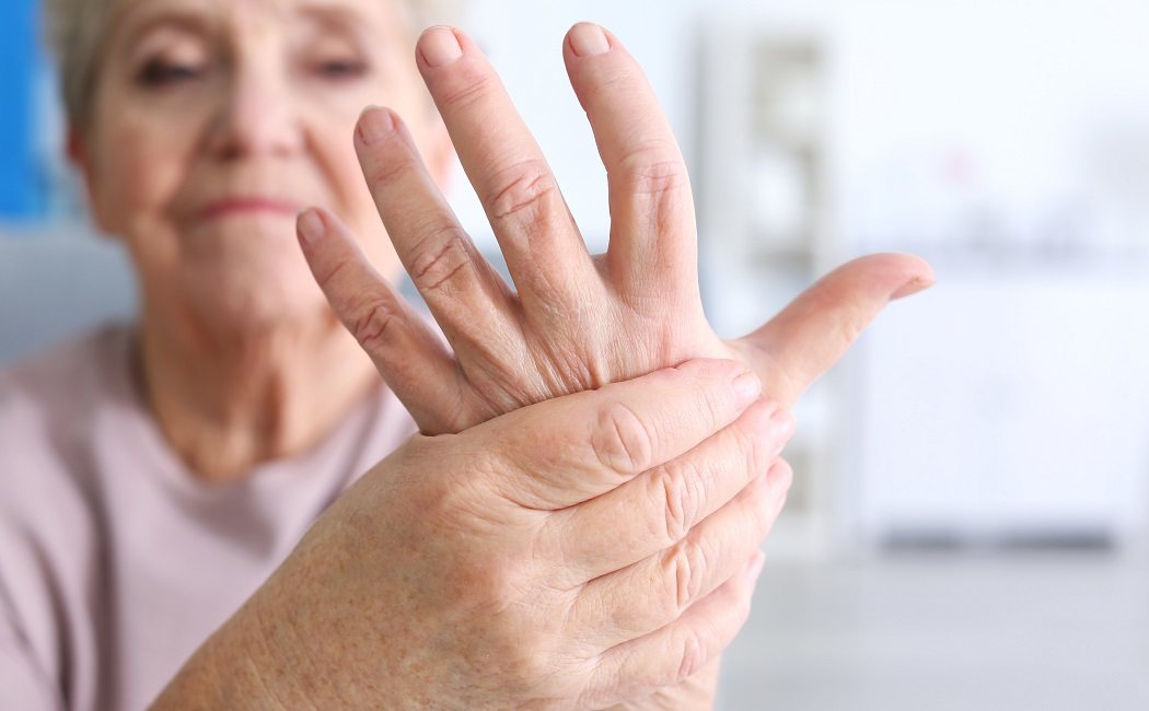 7 cosas que NO sabías sobre la artritis psoriásica