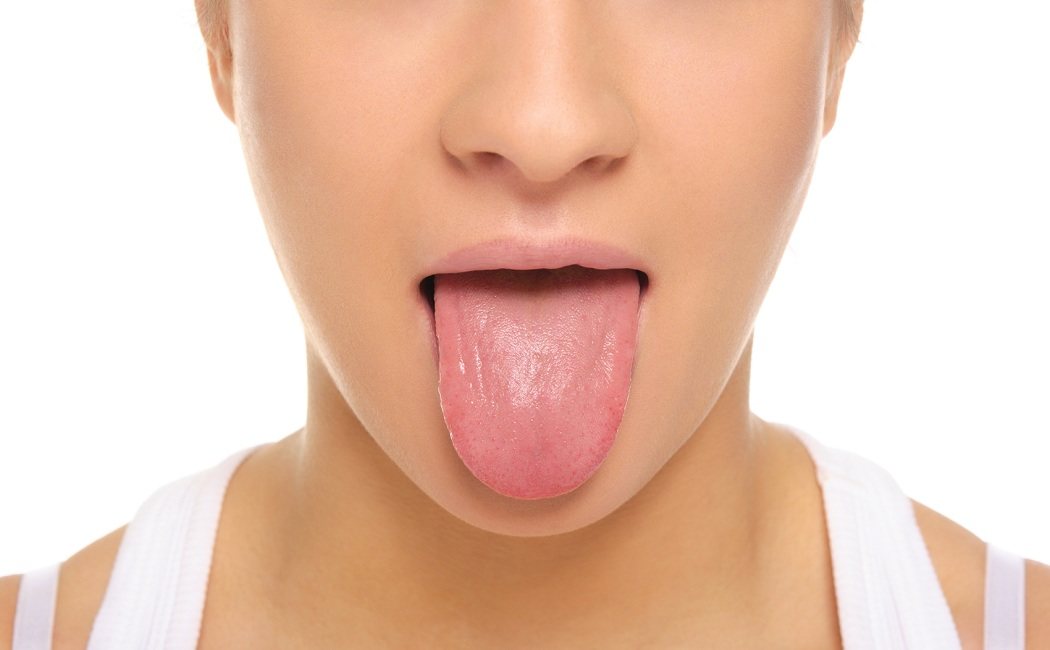 Enfermedades más comunes en la lengua