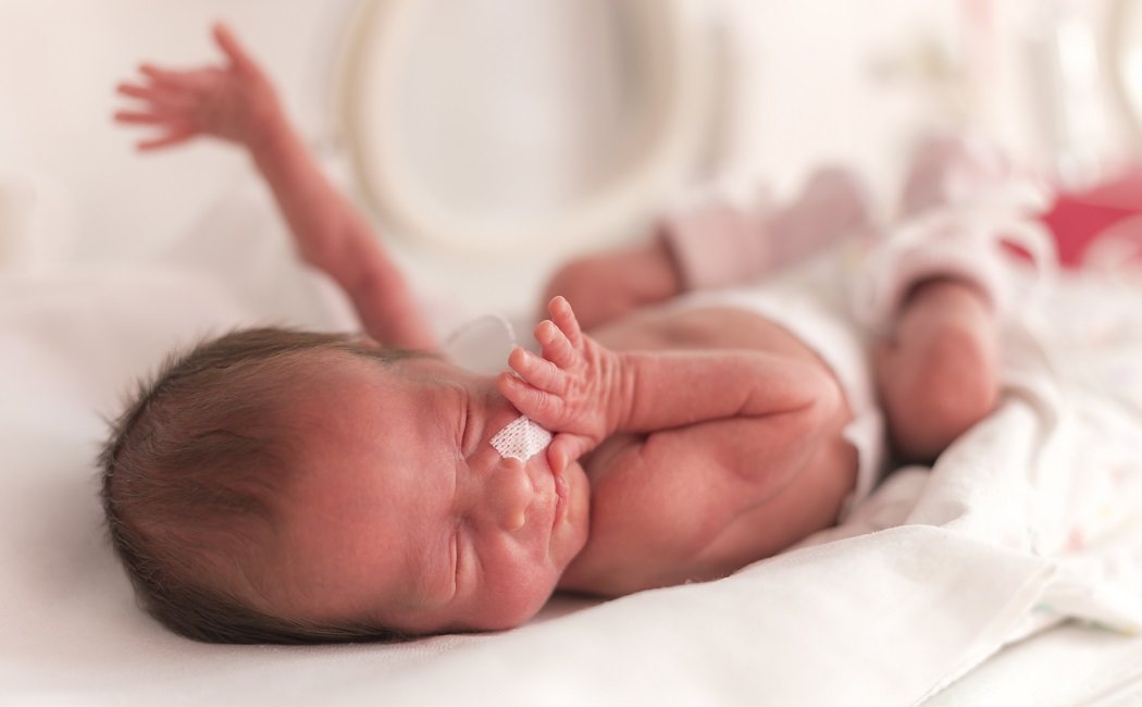 Los edemas en los bebés prematuros