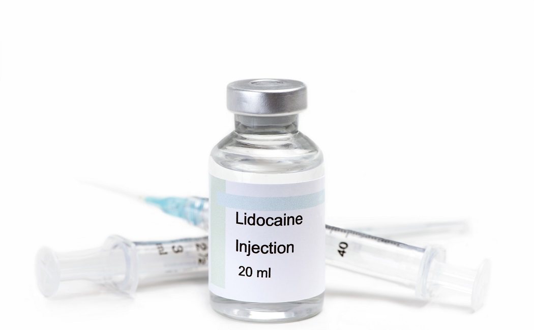 Efectos secundarios de la lidocaína anestésica
