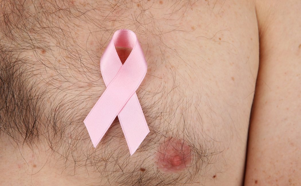 Cáncer de mama en los hombres, ¿hay factores que mejoran los resultados?