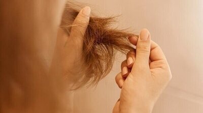 Qué tipos de alopecia sufren las mujeres