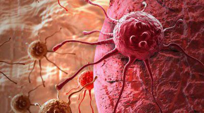 Diferencias entre tumor y cáncer