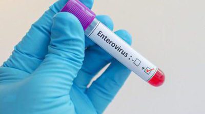 Qué es el enterovirus
