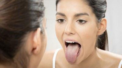 Remedios caseros para tratar la lengua blanca