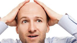 Conoce los diferentes tipos de alopecia