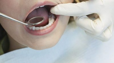 Por qué es tan importante acudir al dentista