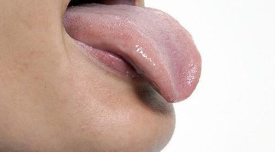 Razones por las que puedes tener la lengua marrón