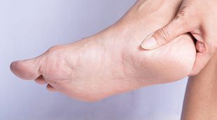 Cuáles son los síntomas de un espolón en el pie o espolón calcáneo