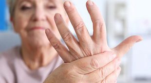 ¿Cuáles son las clases de artritis?