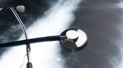 Cuál es el tratamiento para el enfisema pulmonar