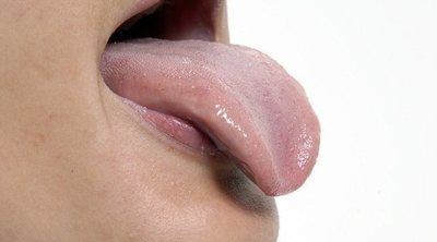 Por qué salen granos en la lengua