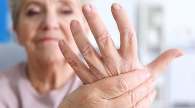 7 cosas que NO sabías sobre la artritis psoriásica