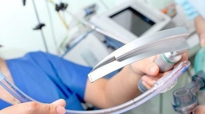 Intubación orotraqueal: qué es y en qué consiste