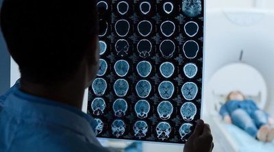Opciones de tratamiento específico en tumores cerebrales