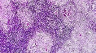 Diferencias principales de las células cancerosas con las normales