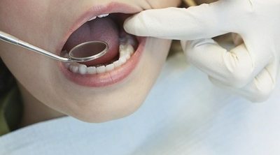 Revisión dental: por qué es importante