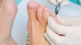Cómo evitar las uñas encarnadas en los pies